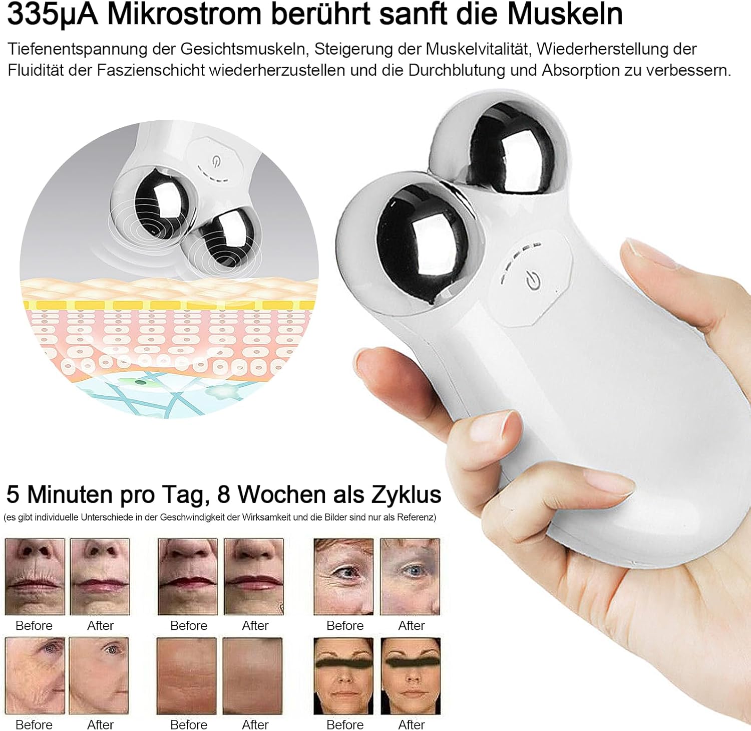 Kyaoayo Mikroáramú Arcmasszírozó - Ránctalanító és Bőrfeszesítő Készülék - Image 3